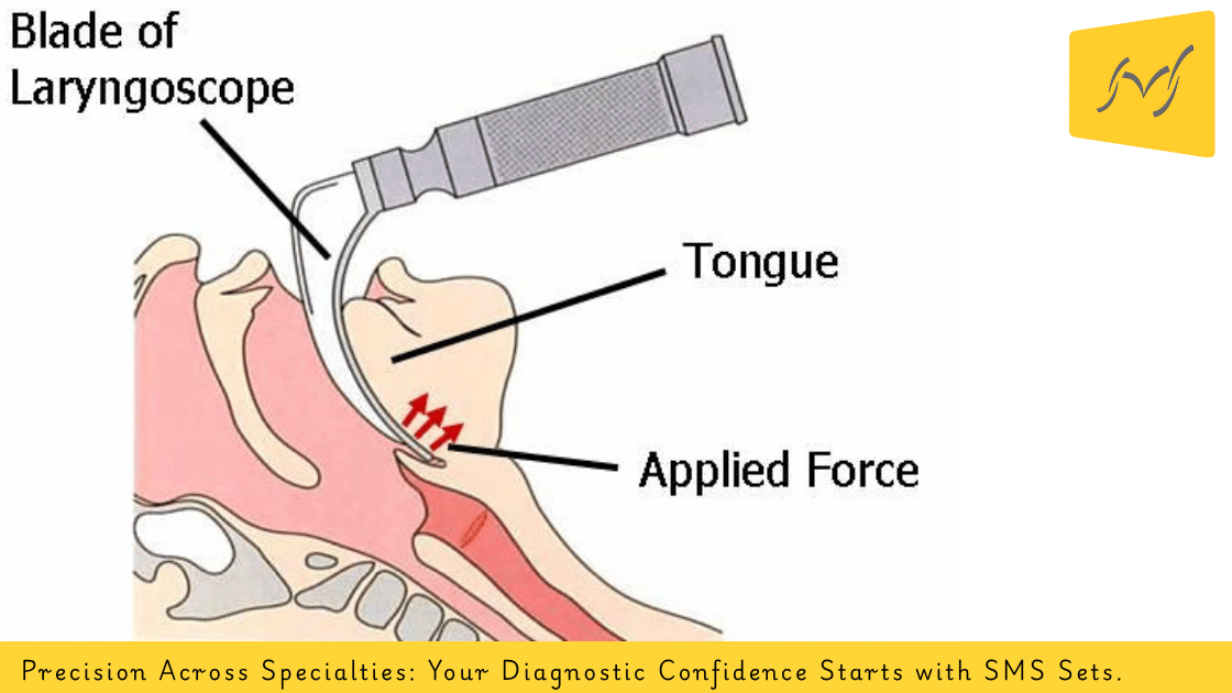 Diagnostic Instruments SMS Sets