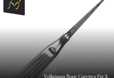 Volkmann Bone Curettes Fig 3: Precision in Every Surgical Move
